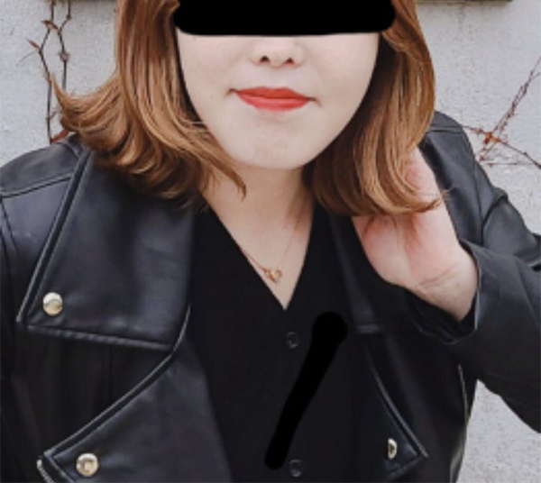 [피부] 별별잉11 - 에어젯, 슈링크