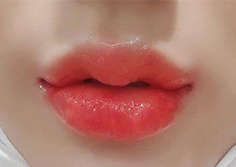 [쁘띠] 다희잉 - 필러