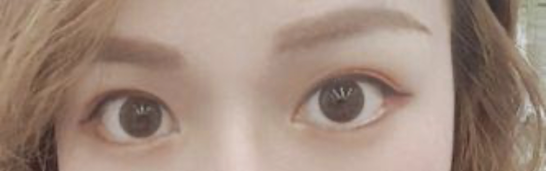 [눈] 임자하고싶은대로해 - 뒤트임,밑트임