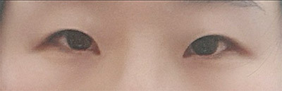 [눈] 핑구찐 - 눈