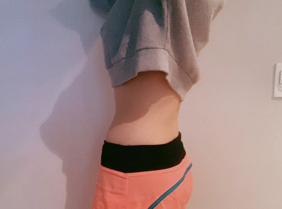 [지방흡입] yedu87 - 다리,복부 지흡