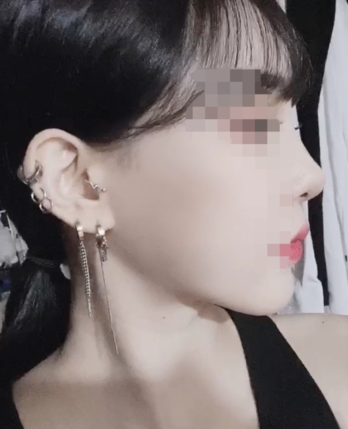 [안면윤곽] 니니❤ - 눈,안면윤곽