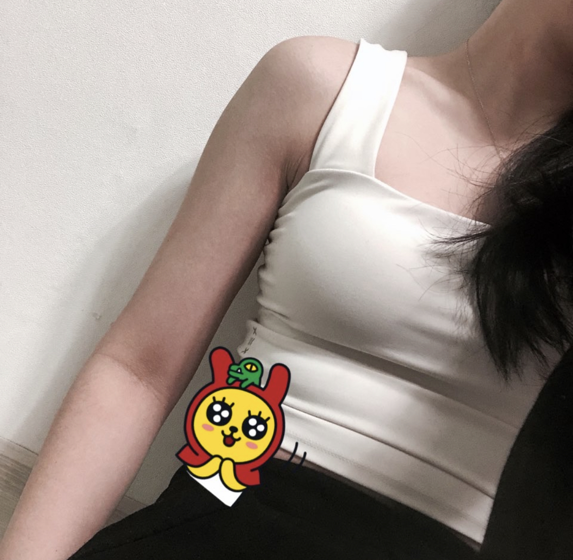 [지방흡입] 힘드로 - 팔지방흡입