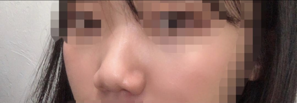 [코] 좌니왜전화안받니 - 코