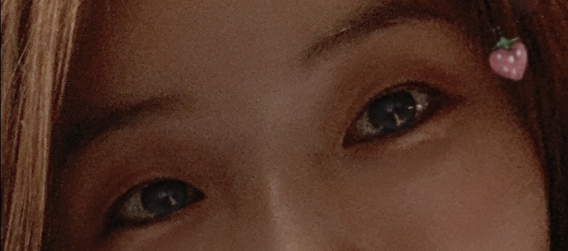 [눈] 하바바하 - 눈매교정,절개