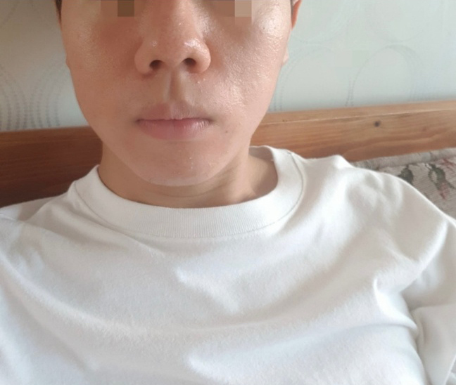 [코] 콧볼하꼬아 - 코