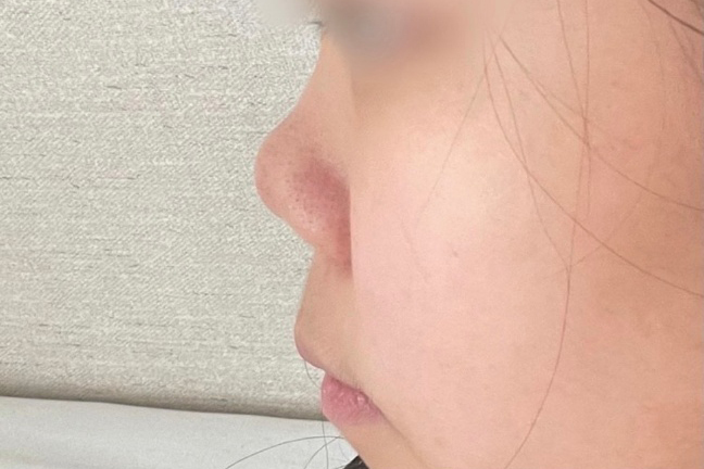 [코] 전지현2 - 콧대