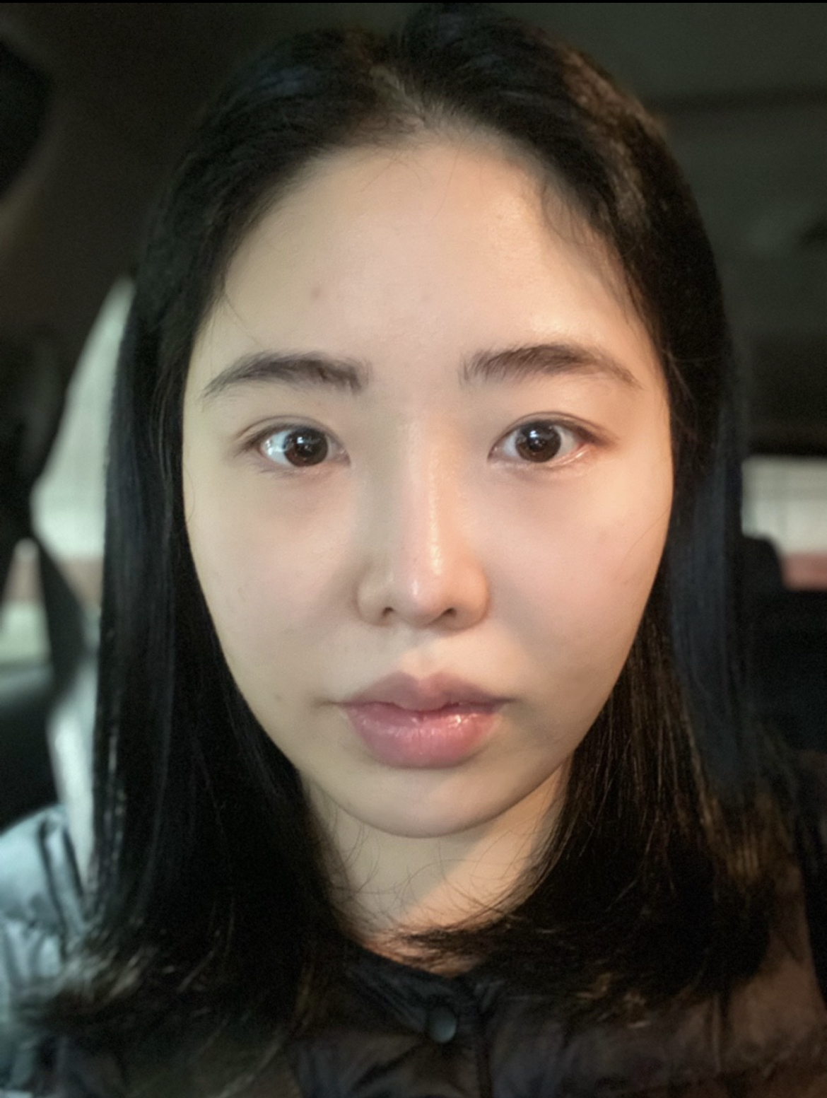 [안면윤곽] 마샬스피커 - 윤곽3종