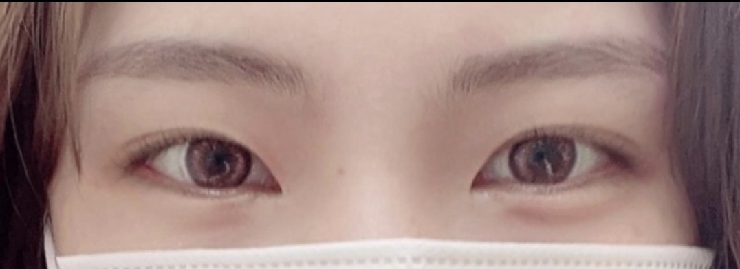 [눈] itxufx - 윗트임,밑트임