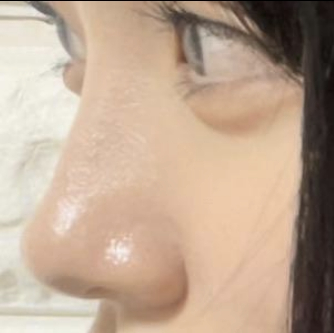 [코] 또또이1 - 코