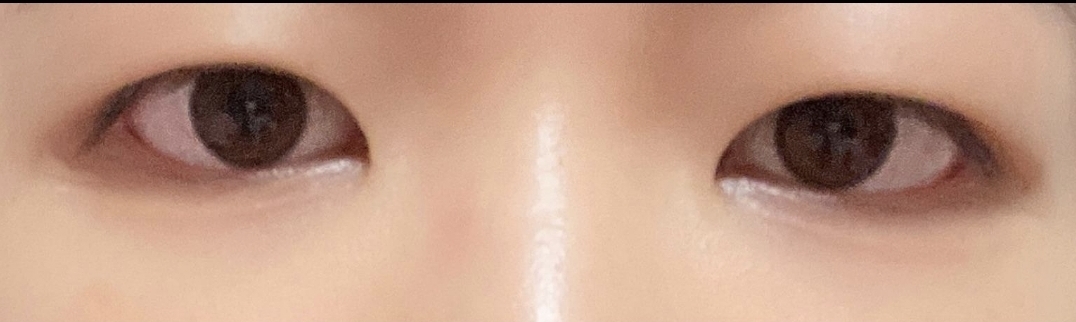 [눈] 하이야이 - 눈