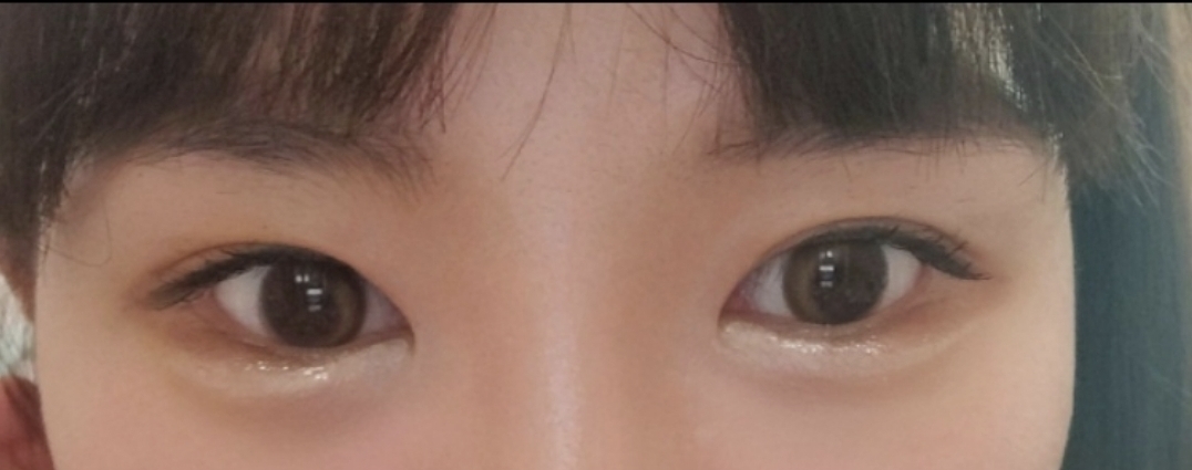 [눈] 징필리우스 - 눈