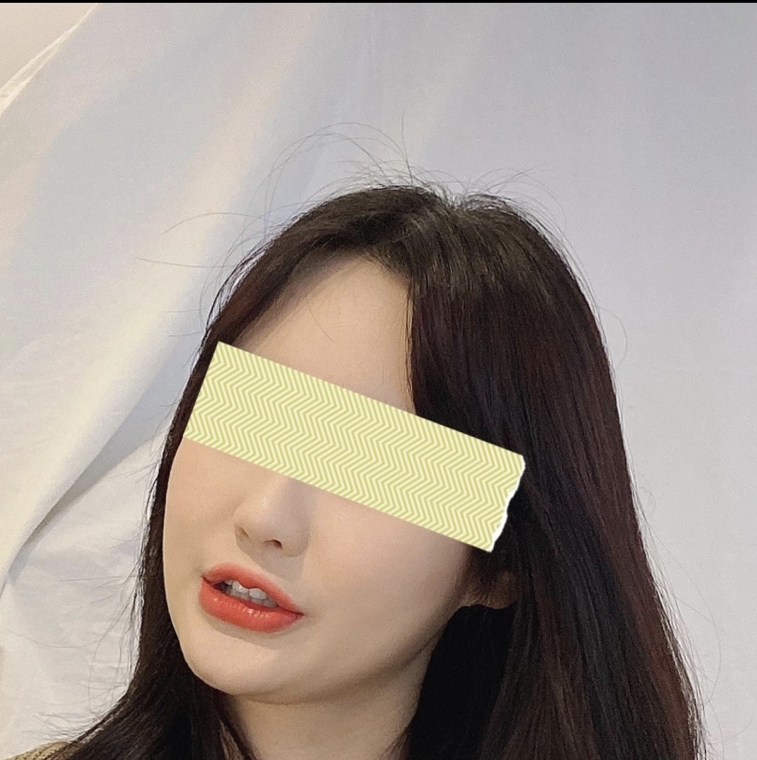 [안면윤곽] 네모의꿈ㅎ - 사각턱
