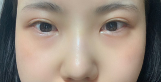 [코] 핑쿠팬더 - 눈,코