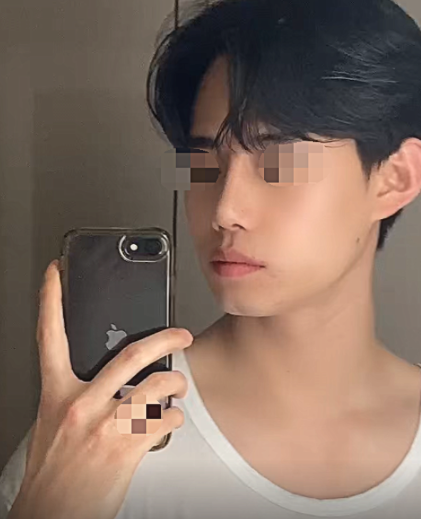 [남자] 곰돌 - 코(미용+기능)