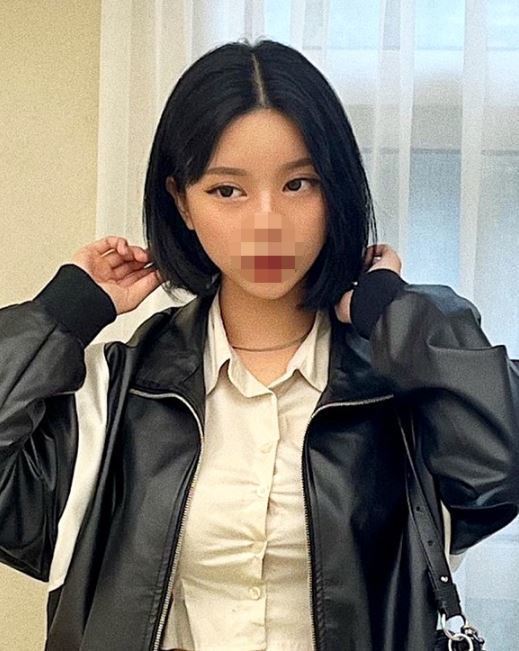 [안면윤곽] Asher - 윤곽2종