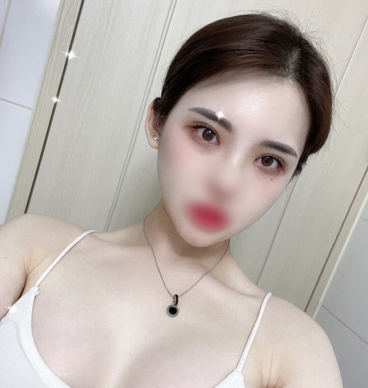 [안면윤곽] 리트리버 - 윤곽,눈