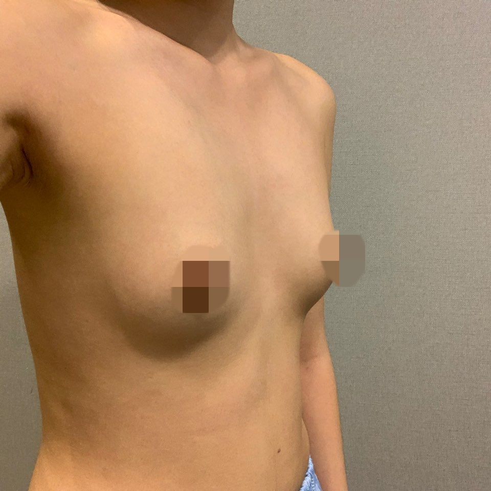 [가슴] 양양양 - 가슴