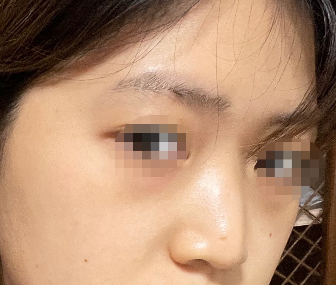 [눈] 순데될라 - 눈,코