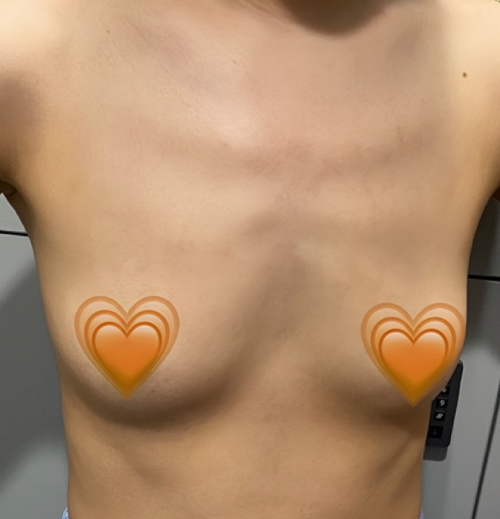 [가슴] 탱탱볼 - 가슴