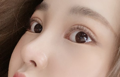 [코] 구름이 - 눈,코