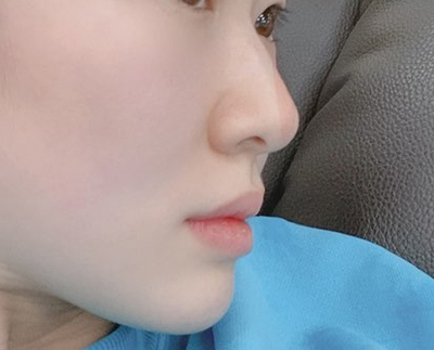 [코] 첫사랑 - 코