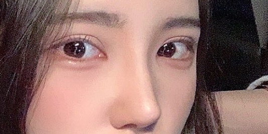 [눈] 녑호 - 눈,코