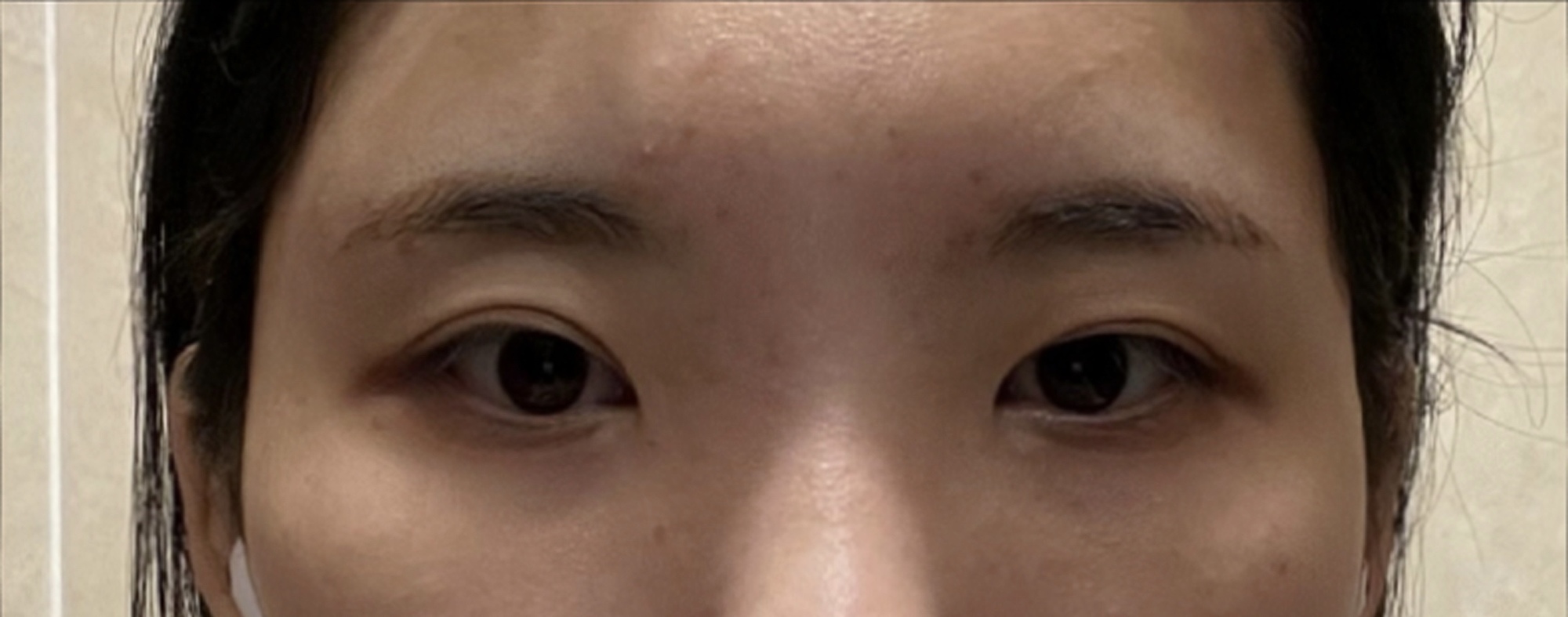 [눈] 모든게다 - 눈