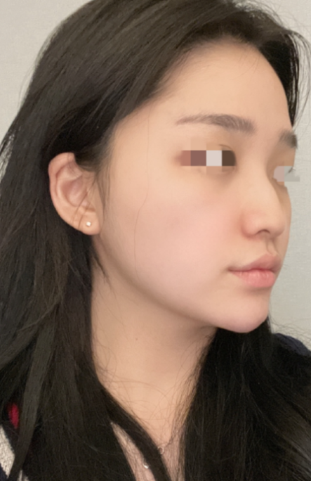 [코] 두둠칫 - 코