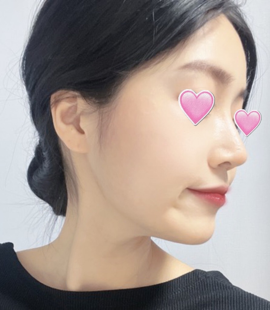 [코] 베비폭스 - 코