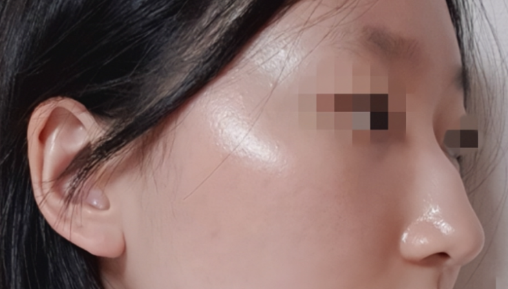 [코] 피노끼오 - 코