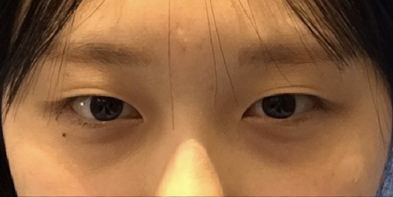 [눈] 얼레리 - 눈