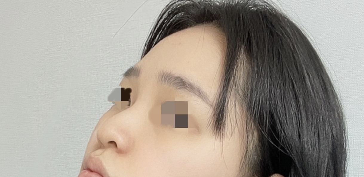 [코] 계절처럼 - 코