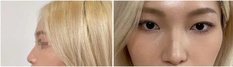 [코] 추어추어 - 코