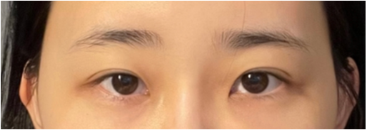 [눈] 유성매직 - 눈