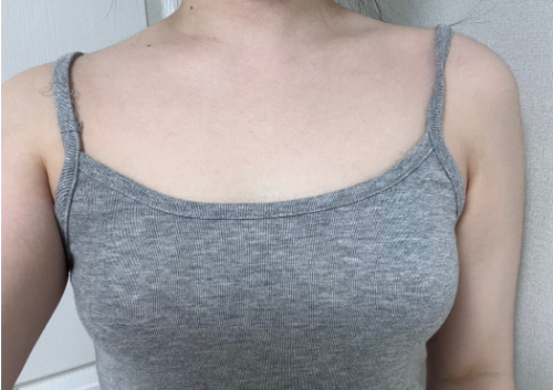 [가슴] 탄산 - 가슴