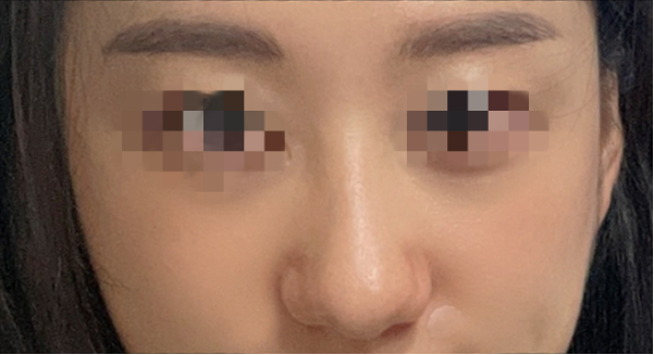 [코] 라이니 - 코