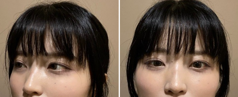 [코] 얄쌍한코 - 코