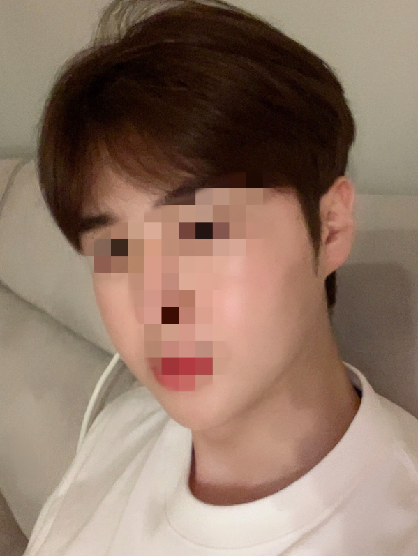 [안면윤곽] 포스틑잇 - 윤곽