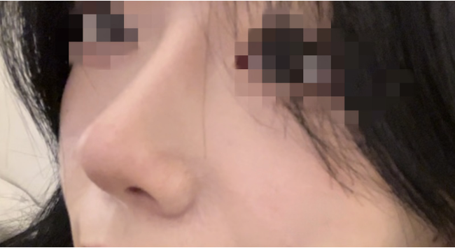 [코] 유리조각 - 코