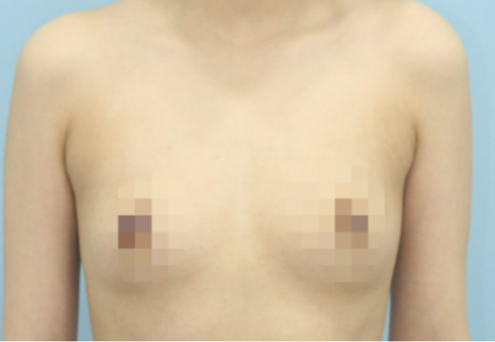 [가슴] 바니래빗 - 가슴