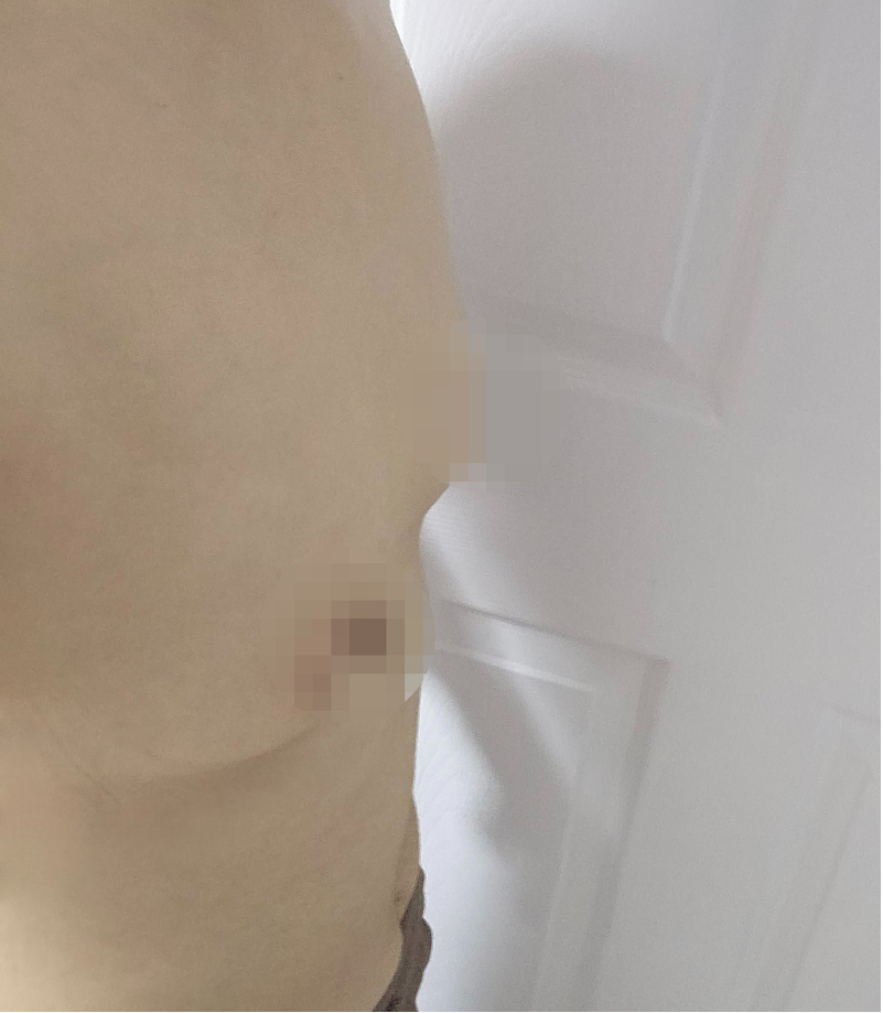 [가슴] 천사채 - 가슴