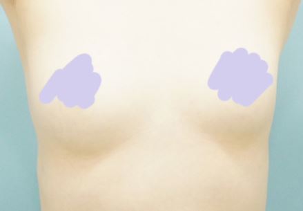 [가슴] 오션프롬더블루 - 가슴