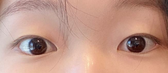 [눈] 꼬부기 - 눈