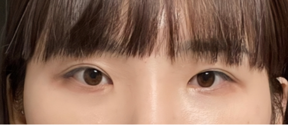 [눈] 데일리아이 - 눈