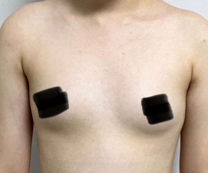 [가슴] 가팅가 - 가슴