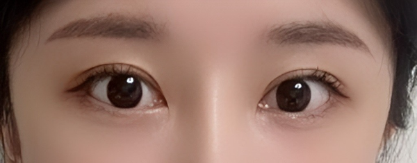 [눈] 눈셍이 - 눈