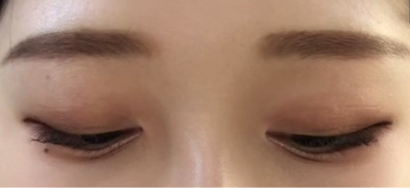 [눈] 생선튀김 - 눈