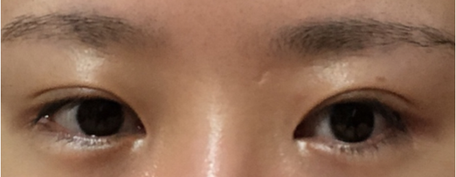 [눈] 정새우 - 눈