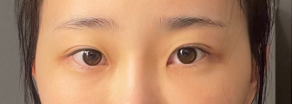 [눈] 풍문으로들었휴 - 눈